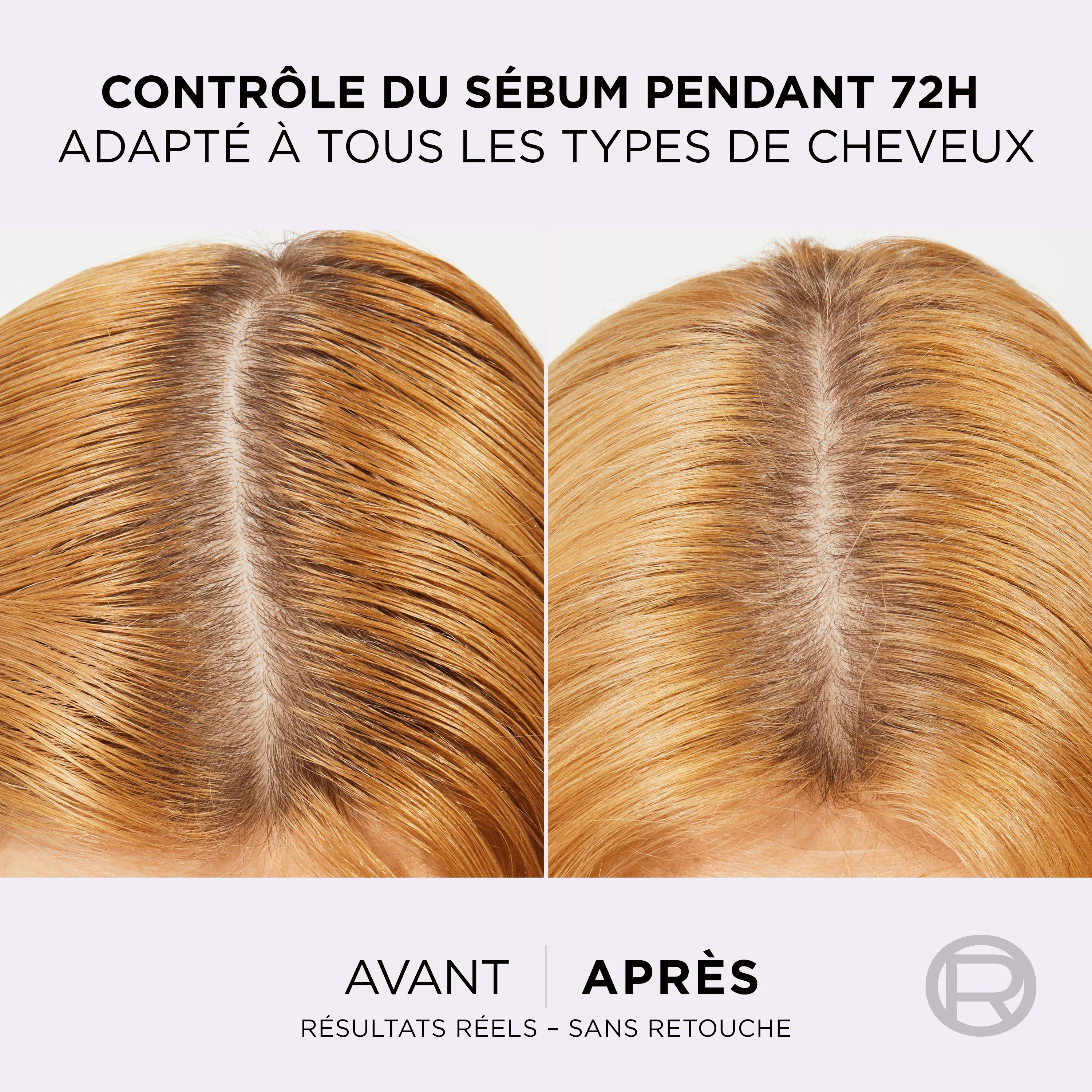Elseve Routine Hyaluron Pure : SHP 200ML + AP SHP 200ML+ SERUM 102ML - Image 6