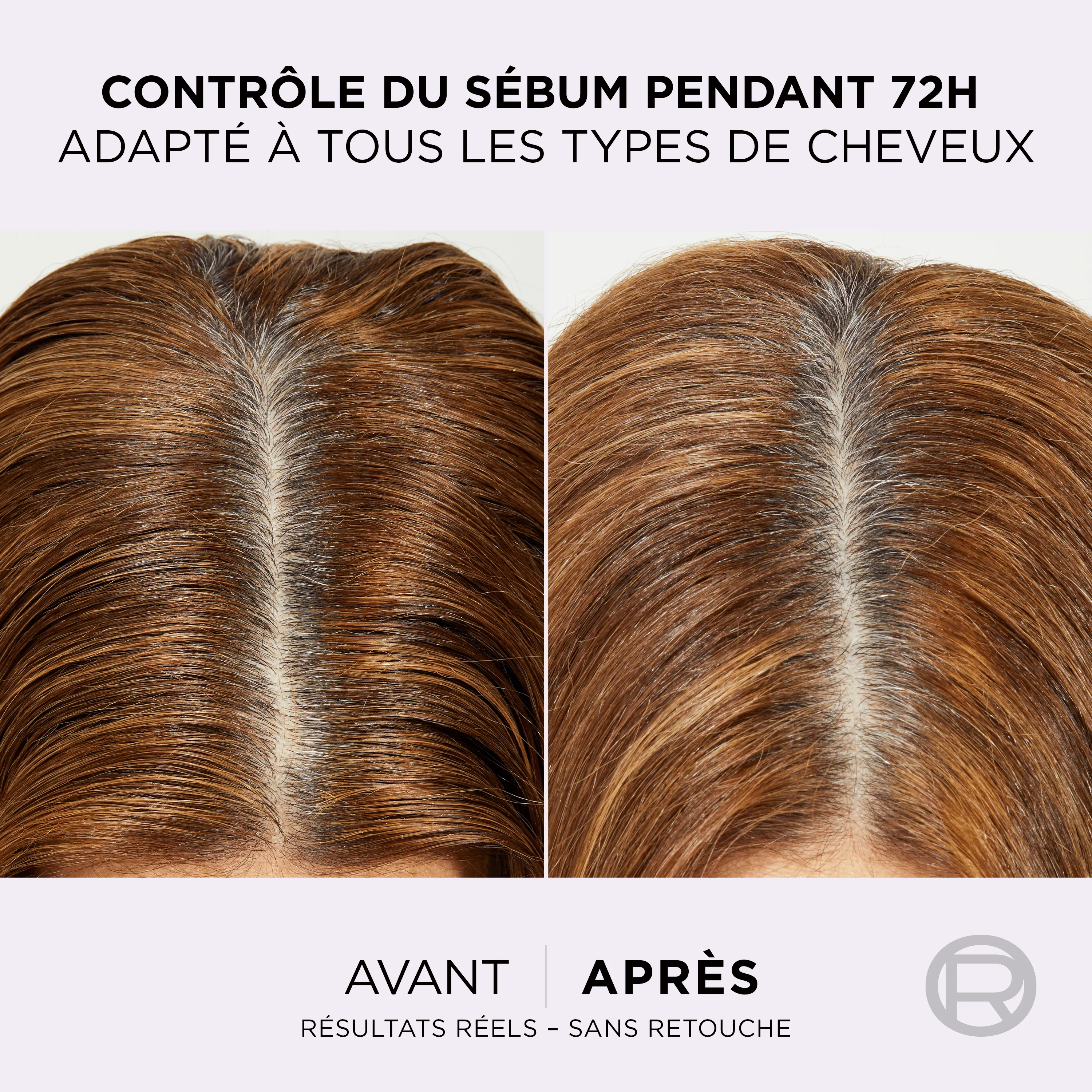 Elseve Routine Hyaluron Pure : SHP 200ML + AP SHP 200ML+ SERUM 102ML - Image 8