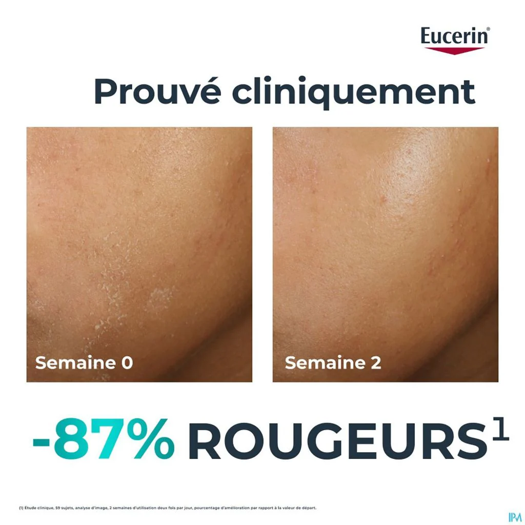 Eucerin – Hydra Crème Compensatrice Apaisante DermoPure – 50 ml - Image 10