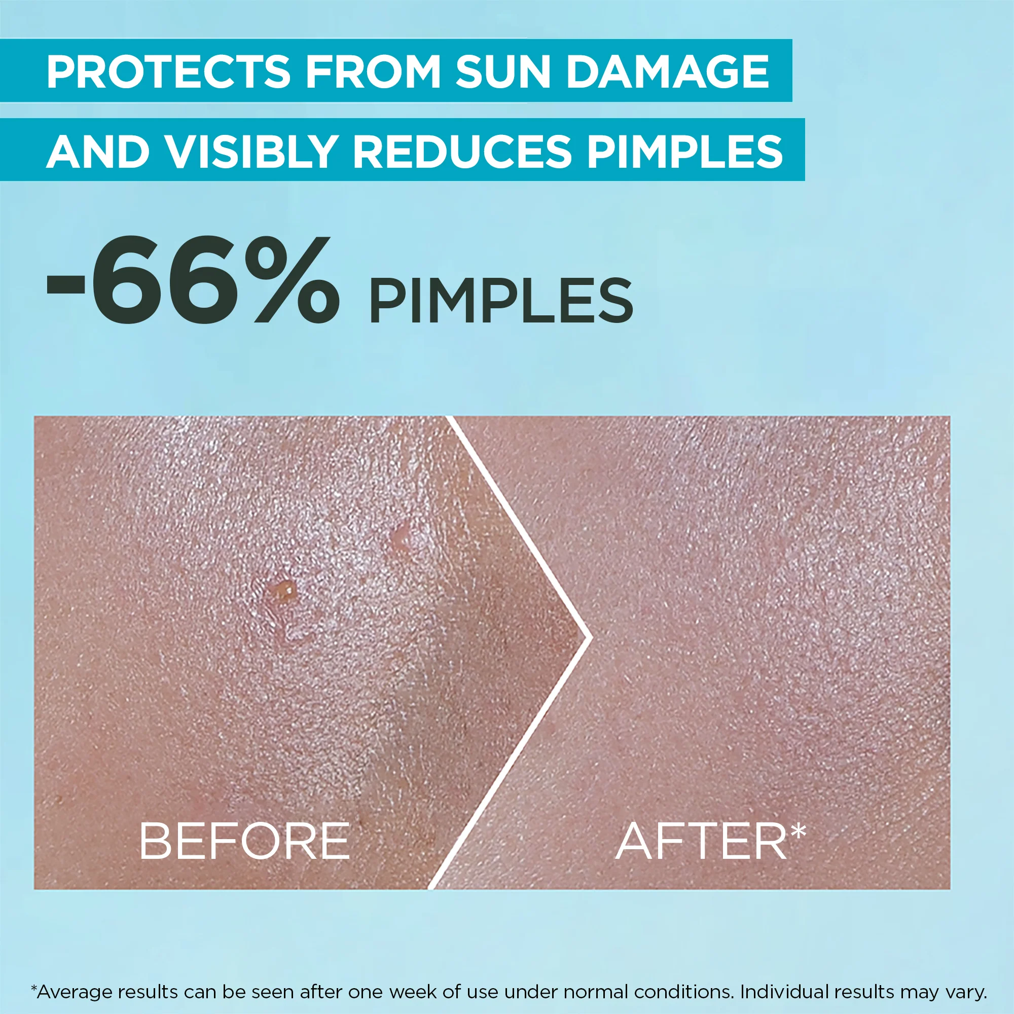 Garnier Super UV Serum Sunscreen SPF50+ PA++++ – Peaux à Imperfections & Anti-Acné - Image 3