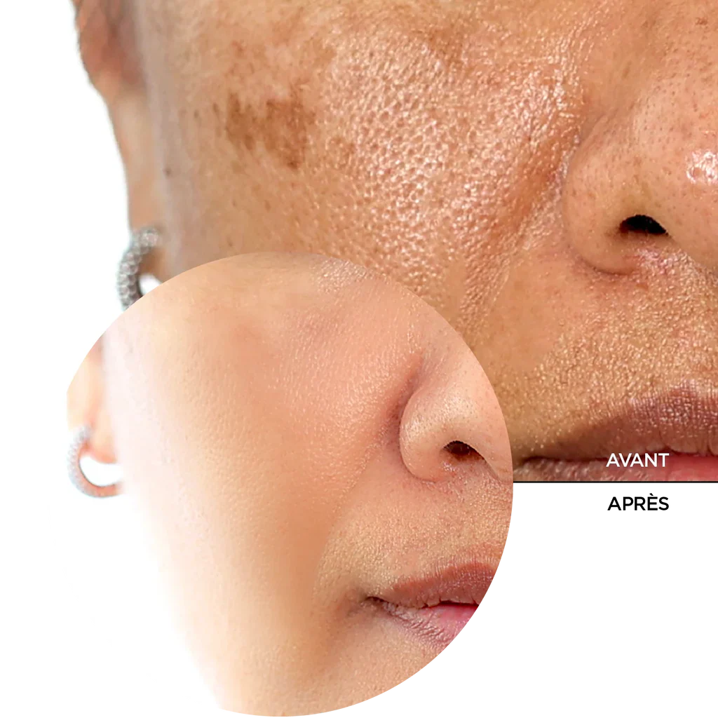 REVOX B77 SKINTREATS BIOTIC RESURFACING ACTIVATOR 30 ML - Image 6